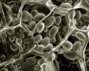 Potato starch granules in potato cells; Image credit: Dr. Philippa Uwins via Wiki Media Commons